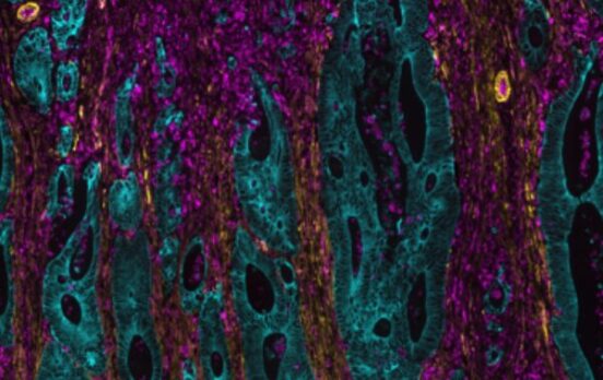 Immunohistochimie Lunaphore Comet