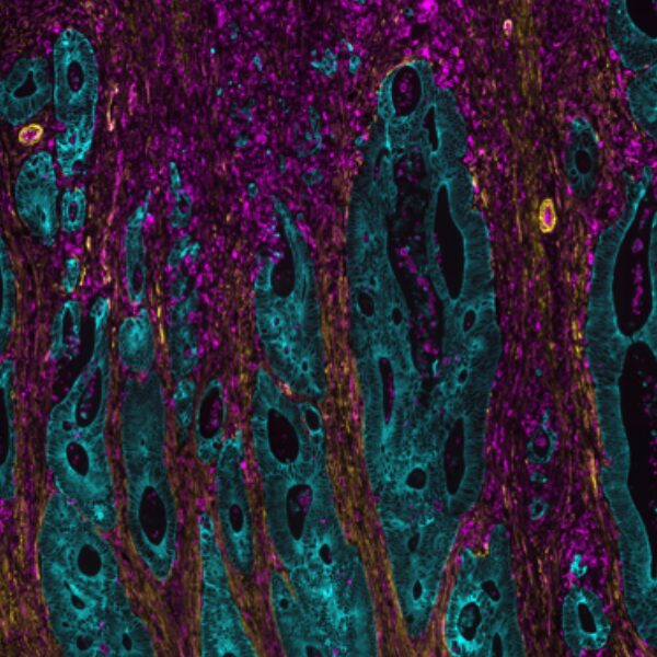 Immunohistochimie Lunaphore Comet